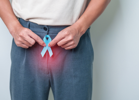 embolisation de la prostate