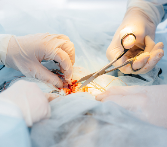 chirurgie carcinologique en Tunisie